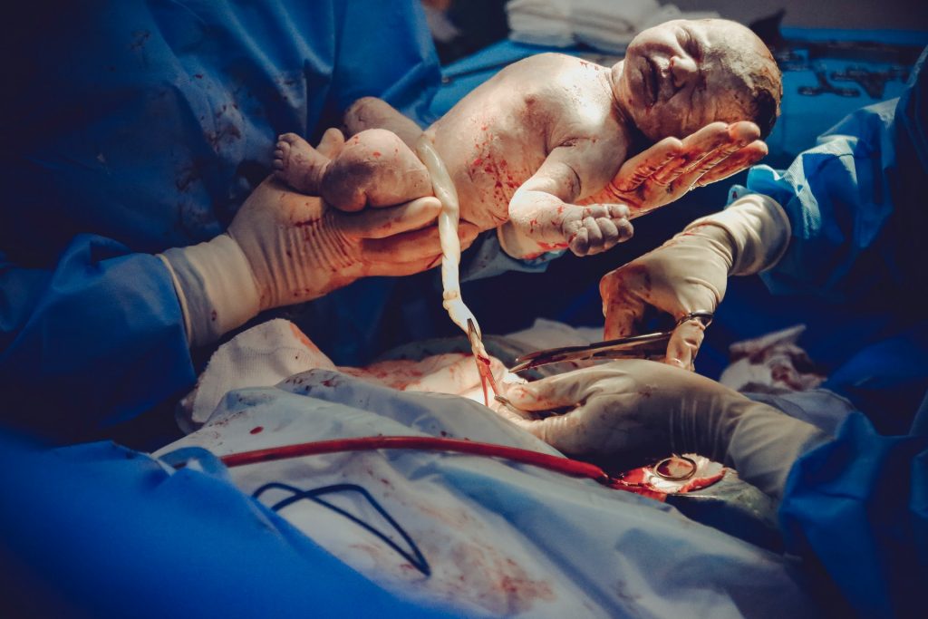 cesarean birth